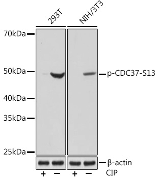 Phospho-CDC37-S13 Monoclonal Antibody [5P8B2]