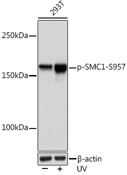 Phospho-SMC1-S957 Monoclonal Antibody [8T9I4]