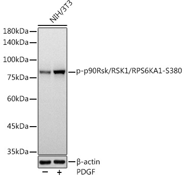 Phospho-p90Rsk/RSK1/RPS6KA1-S380 Monoclonal Antibody [4W0S0]
