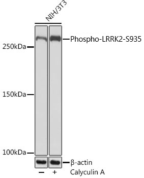 Phospho-LRRK2-S935 Monoclonal Antibody [4J10Z7]