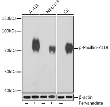 Phospho-Paxillin-Y118 Monoclonal Antibody [2E6P0]