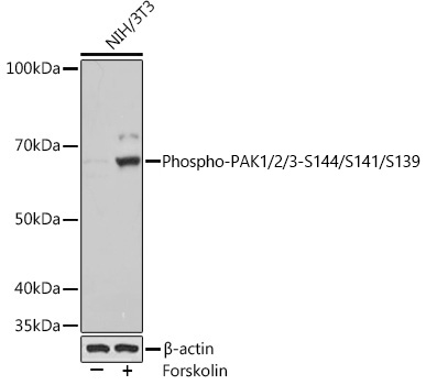 Phospho-PAK1/2/3-S144/S141/S139 Monoclonal Antibody [1T7A5]
