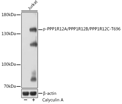 Phospho-PPP1R12A/PPP1R12B/PPP1R12C-T696 Polyclonal Antibody