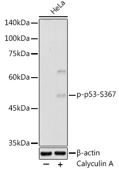Phospho-p53-S367 Polyclonal Antibody