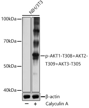 Phospho-AKT1-T308+AKT2-T309+AKT3-T305 Polyclonal Antibody