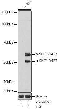 Phospho-SHC1-Y427 Polyclonal Antibody