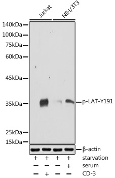 Phospho-LAT-Y191 Polyclonal Antibody