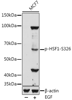 Phospho-HSF1-S326 Polyclonal Antibody
