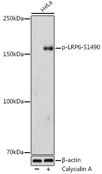 Phospho-LRP6-S1490 Polyclonal Antibody