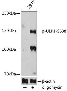 Phospho-ULK1-S638 Polyclonal Antibody