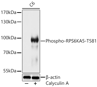 Phospho-RPS6KA5-T581 Polyclonal Antibody
