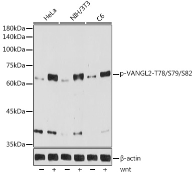 Phospho-VANGL2-T78/S79/S82 Monoclonal Antibody [7H7C2]