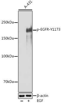 Phospho-EGFR-Y1173 Polyclonal Antibody