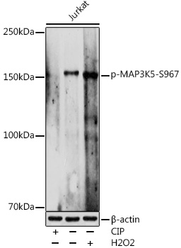 Phospho-MAP3K5-S967 Polyclonal Antibody