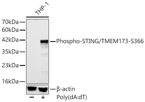 Phospho-STING/TMEM173-S366 Polyclonal Antibody