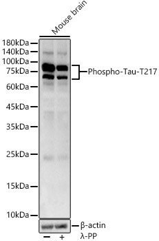 Phospho-Tau-T217 Polyclonal Antibody