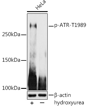 Phospho-ATR-T1989 Polyclonal Antibody