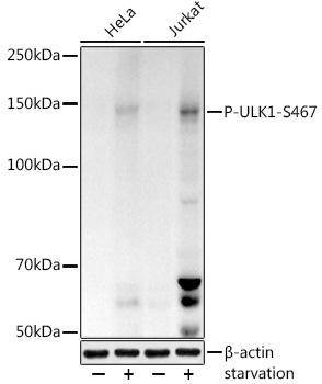 Phospho-ULK1-S467 Polyclonal Antibody