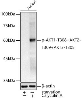 Phospho-AKT1-T308+AKT2-T309+AKT3-T305 Polyclonal Antibody