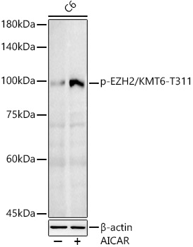 Phospho-EZH2/KMT6-T311 Polyclonal Antibody