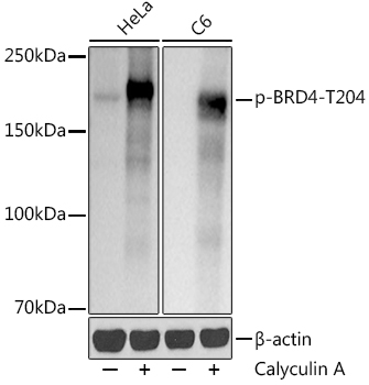 Phospho-BRD4-T204 Monoclonal Antibody [3V5R1]