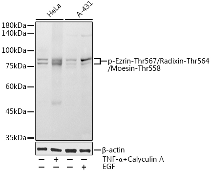 Phospho-Ezrin-Thr567/Radixin-Thr564/Moesin-Thr558 Polyclonal Antibody