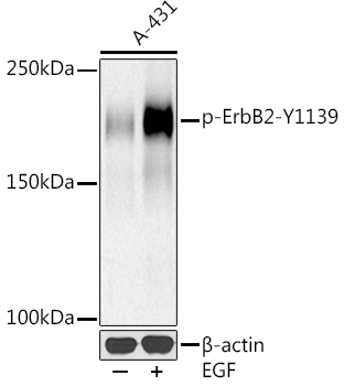 Phospho-HER2/ErbB2-Y1139 Monoclonal Antibody [7N1S0]