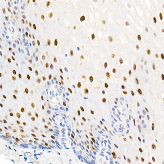 Phospho-Nucleolin-T76 Monoclonal Antibody [5V6R7]
