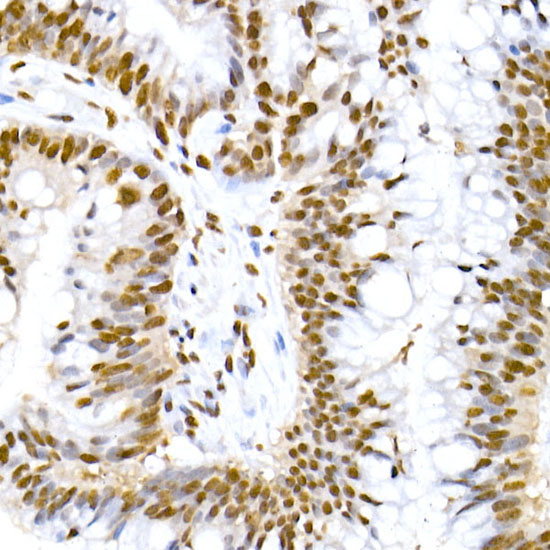 Phospho-MDM2-S166 Monoclonal Antibody [7V0H2]