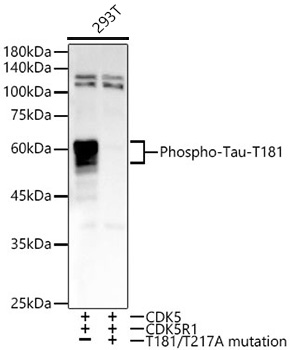 Phospho-Tau-T181 Monoclonal Antibody [6K9A7]