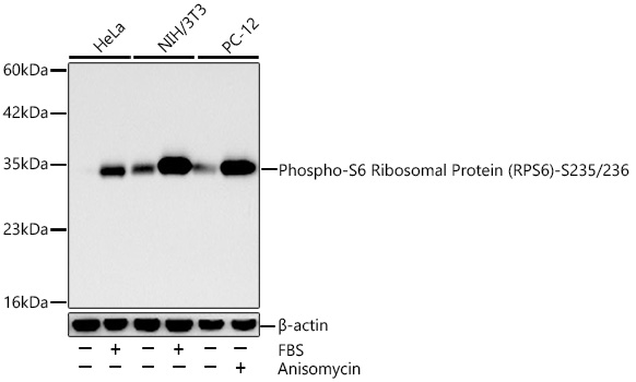 Phospho-S6 Ribosomal Protein (RPS6)-S235/236 Monoclonal Antibody [5X3T9]