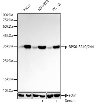 Phospho-S6 Ribosomal Protein (RPS6)-S240/244 Monoclonal Antibody [9H1B7]