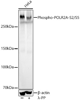 Phospho-Rpb1 CTD-S2/S5 Monoclonal Antibody [10W0C8]