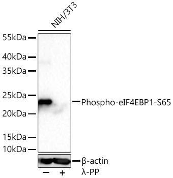 Phospho-eIF4EBP1-S65 Monoclonal Antibody [9M4D7]