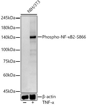 Phospho-NF-kappaB2-S866 Monoclonal Antibody [1J7E2]
