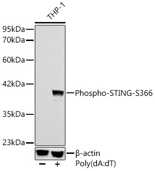 Phospho-STING/TMEM173-S366 Monoclonal Antibody [4U3G8]