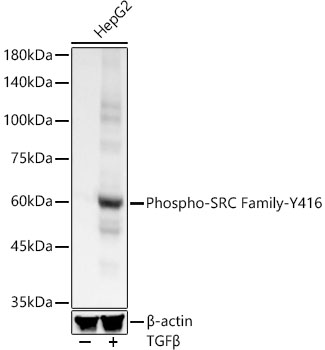 Phospho-SRC Family-Y416 Monoclonal Antibody [8W3U0]
