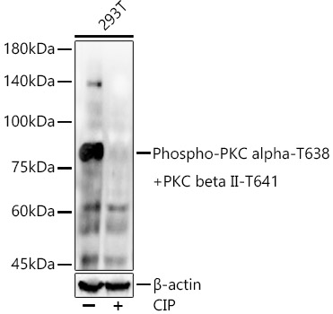 Phospho-PKC alpha-T638 + PKC beta II-T641 Monoclonal Antibody [8D8L5]