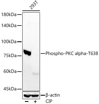 Phospho-PKC alpha-T638 Monoclonal Antibody [5J5Y4]