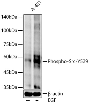 Phospho-Src-Y529 Monoclonal Antibody [7R10U9]