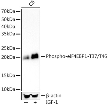 Phospho-eIF4EBP1-T37/T46 Monoclonal Antibody [5V9O2]