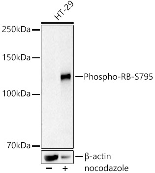 Phospho-RB-S795 Monoclonal Antibody [9G5K3]