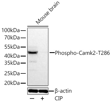 Phospho-Camk2-T286 Monoclonal Antibody [10G8J4]