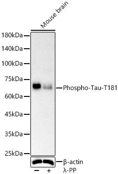 Phospho-Tau-T181 Monoclonal Antibody [4R1G6]