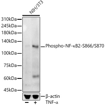 Phospho-NF-kappaB2-S866/S870 Monoclonal Antibody [6W9S2]