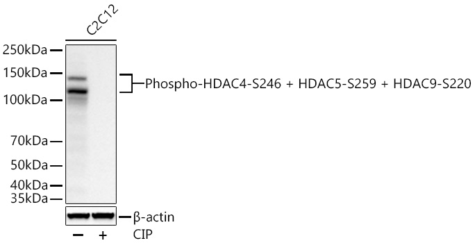 Phospho-HDAC4-S246 + HDAC5-S259 + HDAC9-S220 Monoclonal Antibody [8H4J9]
