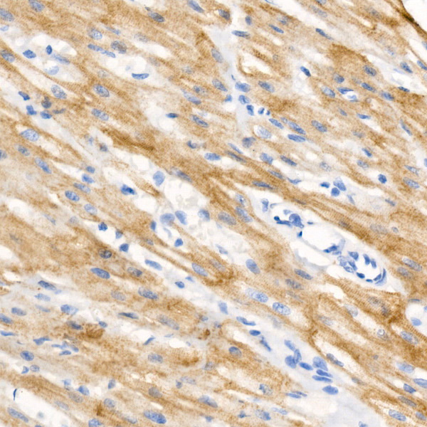 Phospho-Cardiac Troponin I (TNNI3)-S23/S24 Monoclonal Antibody [9G7R2]