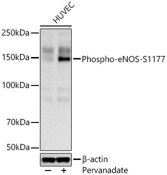 Phospho-eNOS-S1177 Monoclonal Antibody [8W8T7]