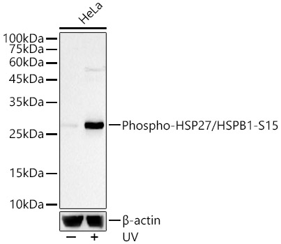 Phospho-HSP27/HSPB1-S15 Monoclonal Antibody [4D4C5]