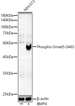 Phospho-Smad5-S465 Monoclonal Antibody [2Q7T2]